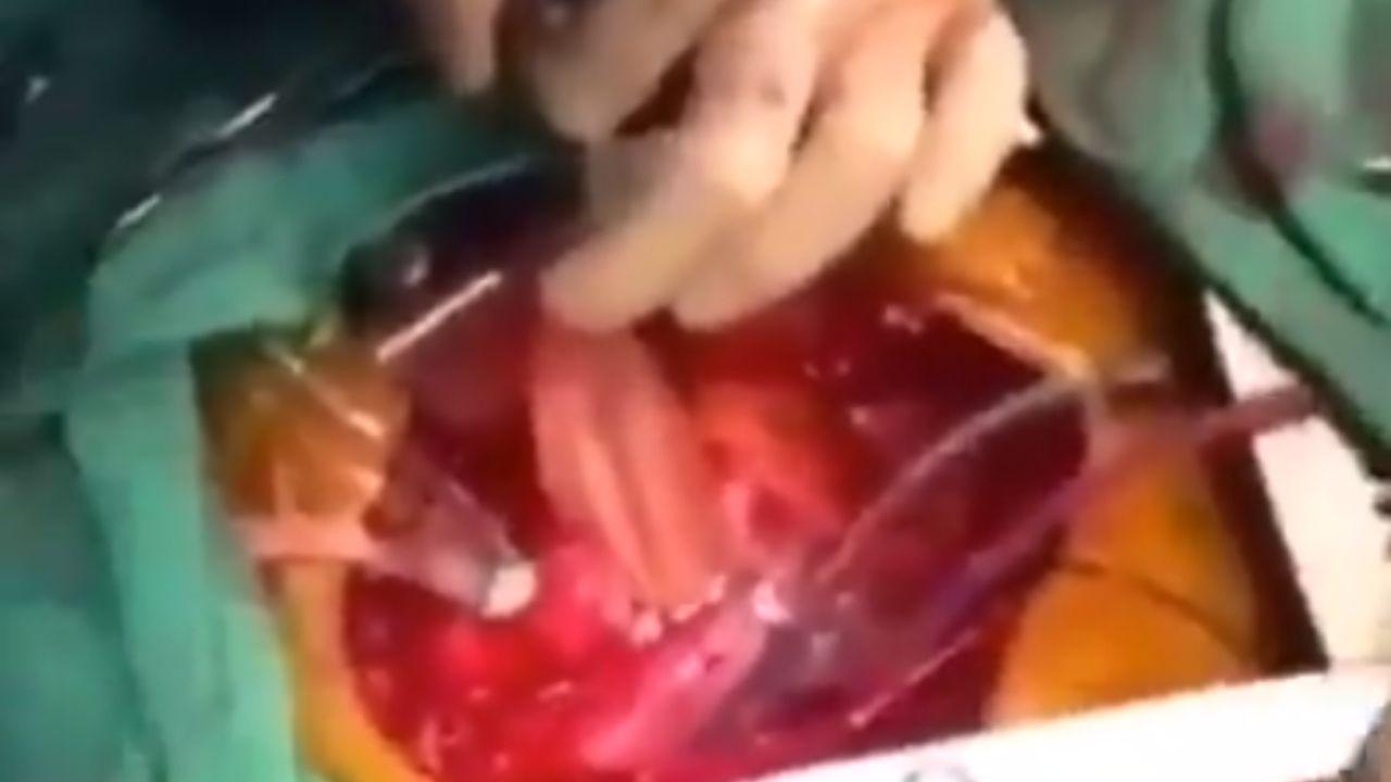 Imagen Principal de Nota: En pleno sismo en México, médico realizó cirugía de corazón mientras rezaba