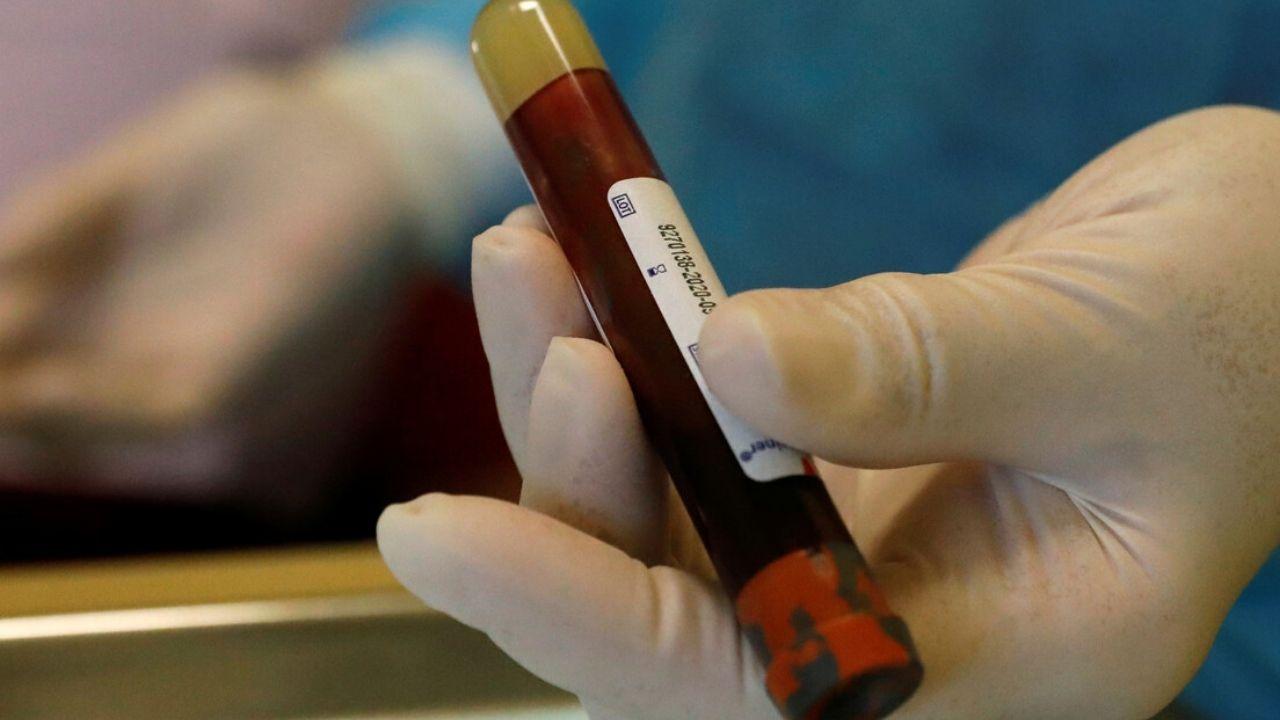 Imagen Principal de Nota: Coronavirus: Autopsias de fallecidos revelan que el covid-19 provoca algo terrible en casi todos los órganos del cuerpo