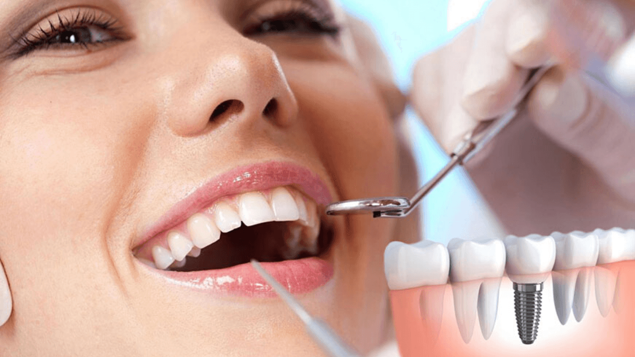 Imagen Principal de Nota: Las Mañanas del 5: Antes de ponerte un puente o implante dental, esto es lo que debes saber