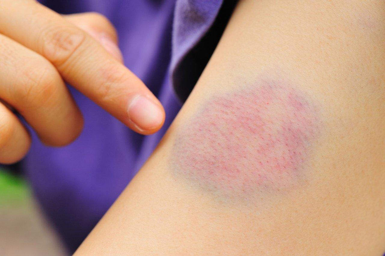 Imagen Principal de Nota: ¡Alerta! Estos son los primeros síntomas del cáncer silencioso