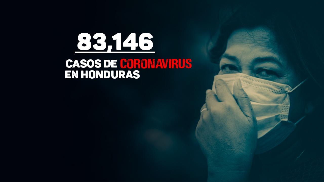 Imagen Principal de Nota: Honduras suma 594 pacientes contagiados de covid; cifra total asciende a 83,146