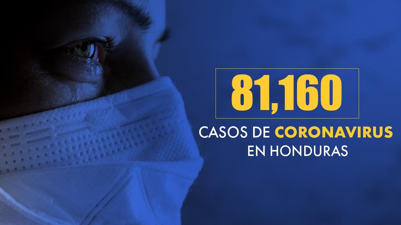 Imagen de Honduras llega a más de 81 mil casos tras confirmarse 498 nuevas infecciones de covid