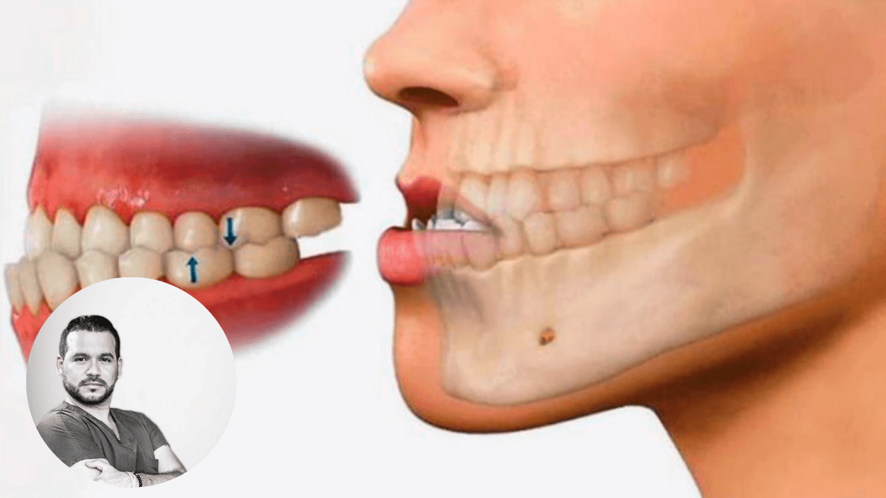 Imagen de Las Mañanas del 5: ¿Cuáles son los tipos incorrectos de mordida?, el dentista del rock lo explica