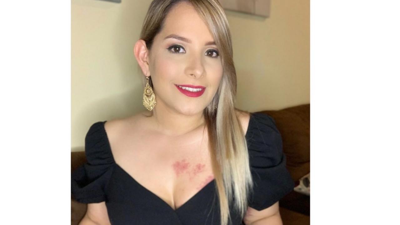 Imagen Principal de Nota: Tanya Rodríguez sufre depresión luego de superar el covid-19
