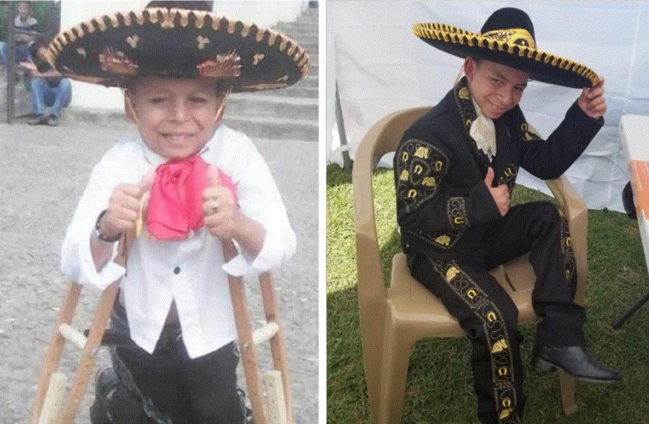 Imagen de Marlon Yasir 'El niño de oro' ya puede caminar tras más de 24 cirugías y así se mostró con sus seguidores