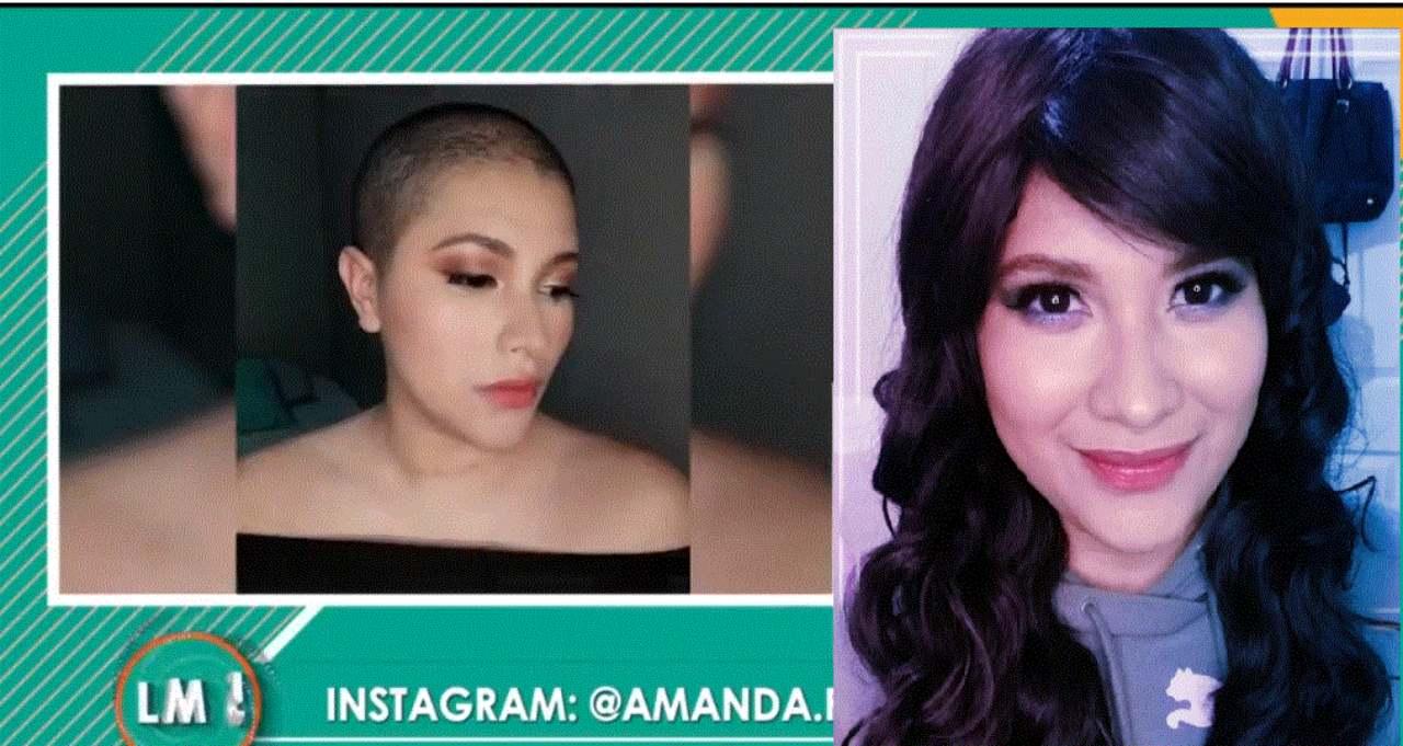 Imagen de ‘Ahora son días menos a tu vida’: el duro testimonio de la hondureña Amanda Fonck tras ser positivo al cáncer