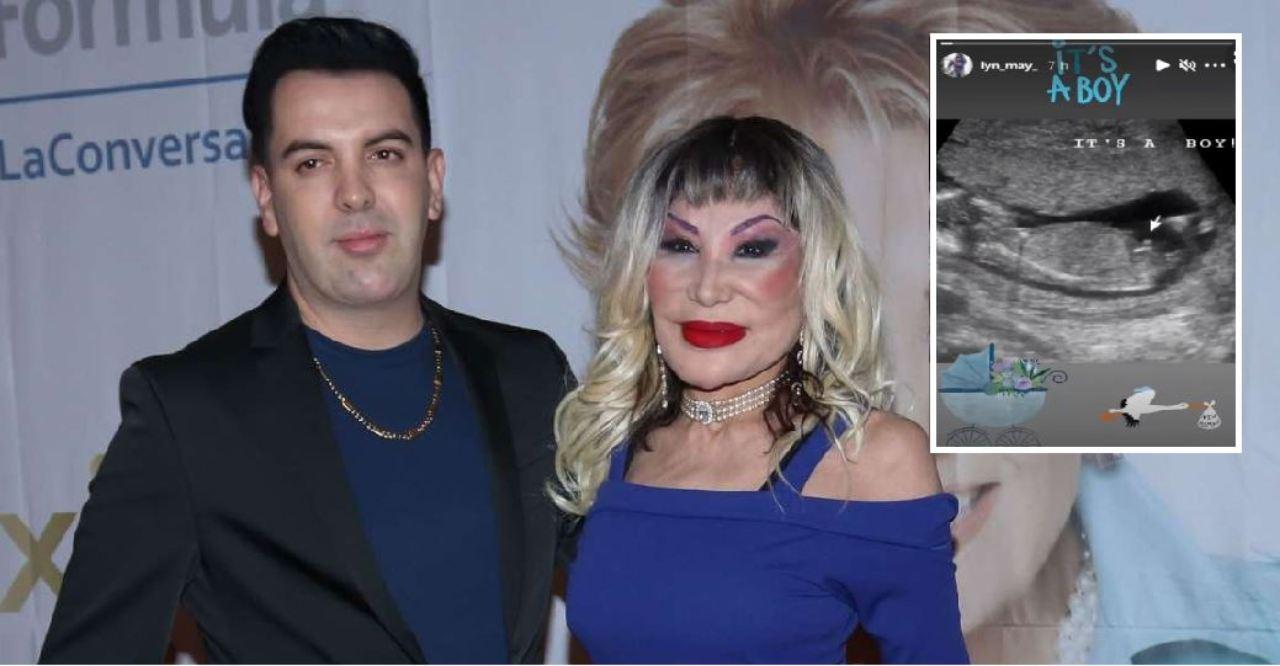 Imagen Principal de Nota: Lyn May reveló el sexo de su bebé con ultrasonido y sigue causando furor con embarazo a los 68 años