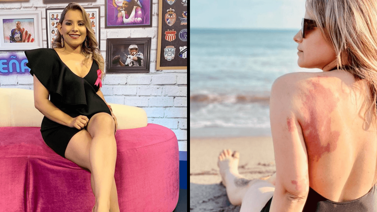 Imagen Principal de Nota: ¡Foto! Tanya Rodríguez muestra su lunar completo y publica inspirador mensaje