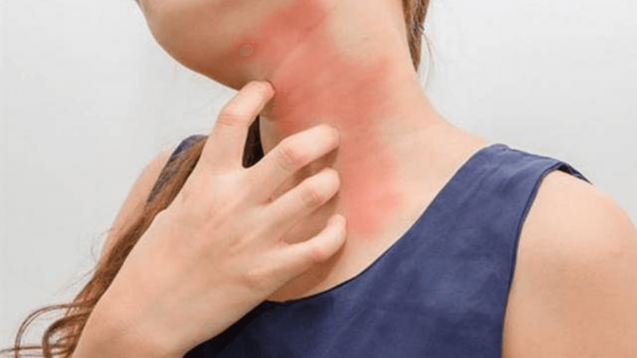 Imagen de ¿Cómo evitar las alergias propias del verano?