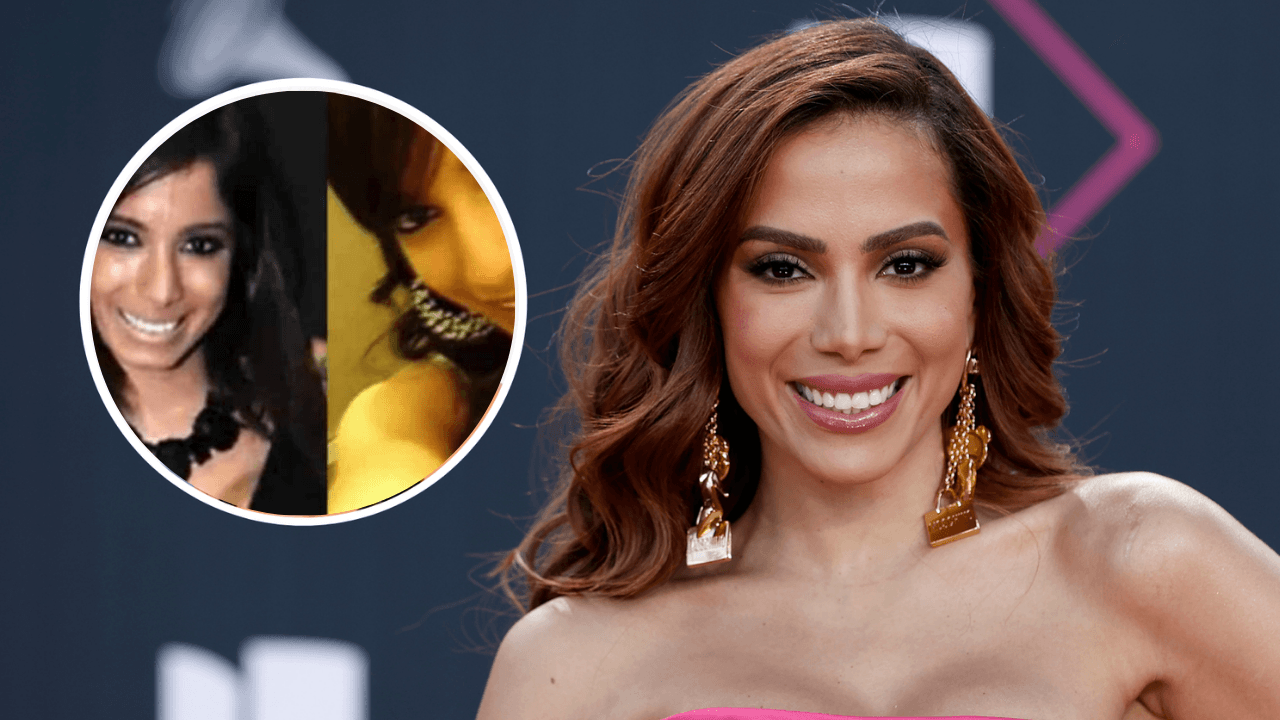 Imagen de Irreconocible: Anitta revela cuantas cirugías plásticas se ha realizado para verse esbelta