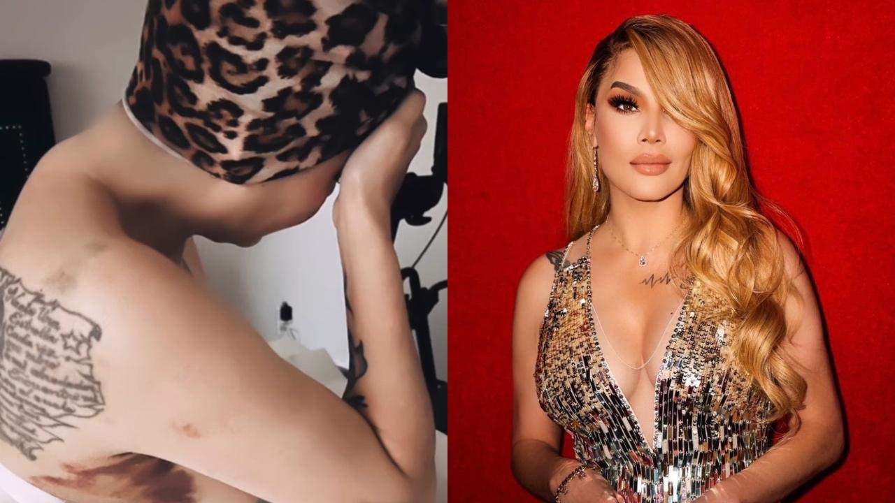 Imagen Principal de Nota: Ivy Queen comparte alarmantes imágenes que preocupa a sus seguidores