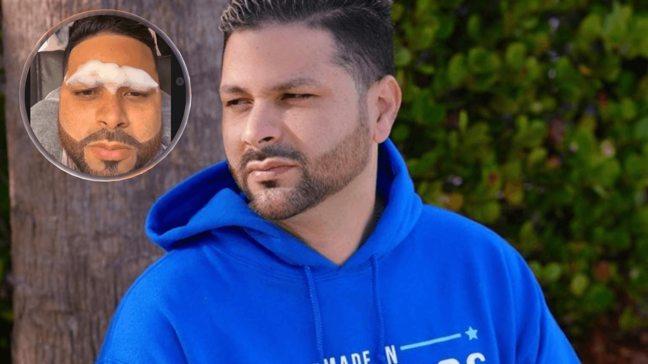 Imagen Principal de Nota: Jorge Cordero sorprende a seguidores al realizarse el microblading  y otros arreglitos, mira cómo luce