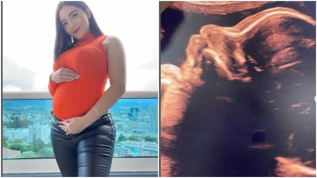 Imagen Principal de Nota: ¡Qué ternura! Carla Cubas reveló cuál será el nombre de su primera hija