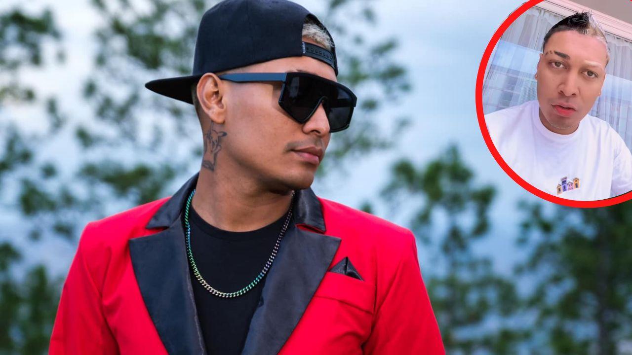 Imagen Principal de Nota: 'Como dálmata': así luce  Supremo con su cambio de look