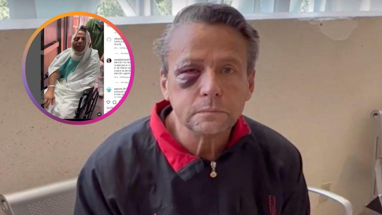 Imagen Principal de Nota: Impactantes imágenes de Alfredo Aldame al salir del hospital tras ser operado de emergencia