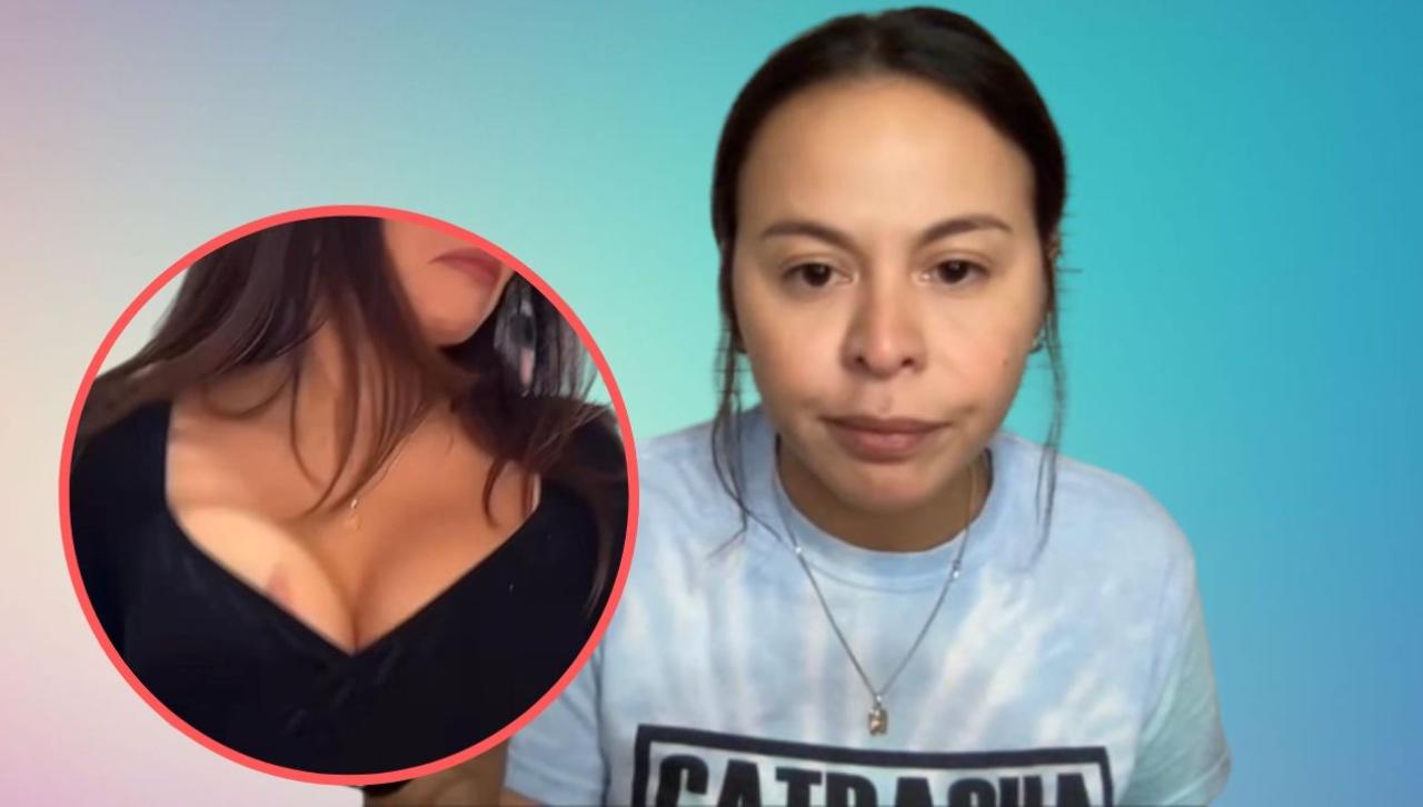 Imagen Principal de Nota: Así reaccionó 'Lipstickfables' al ser llamada ‘chusma’ por aparecer con ‘chupetón’ en su cuerpo