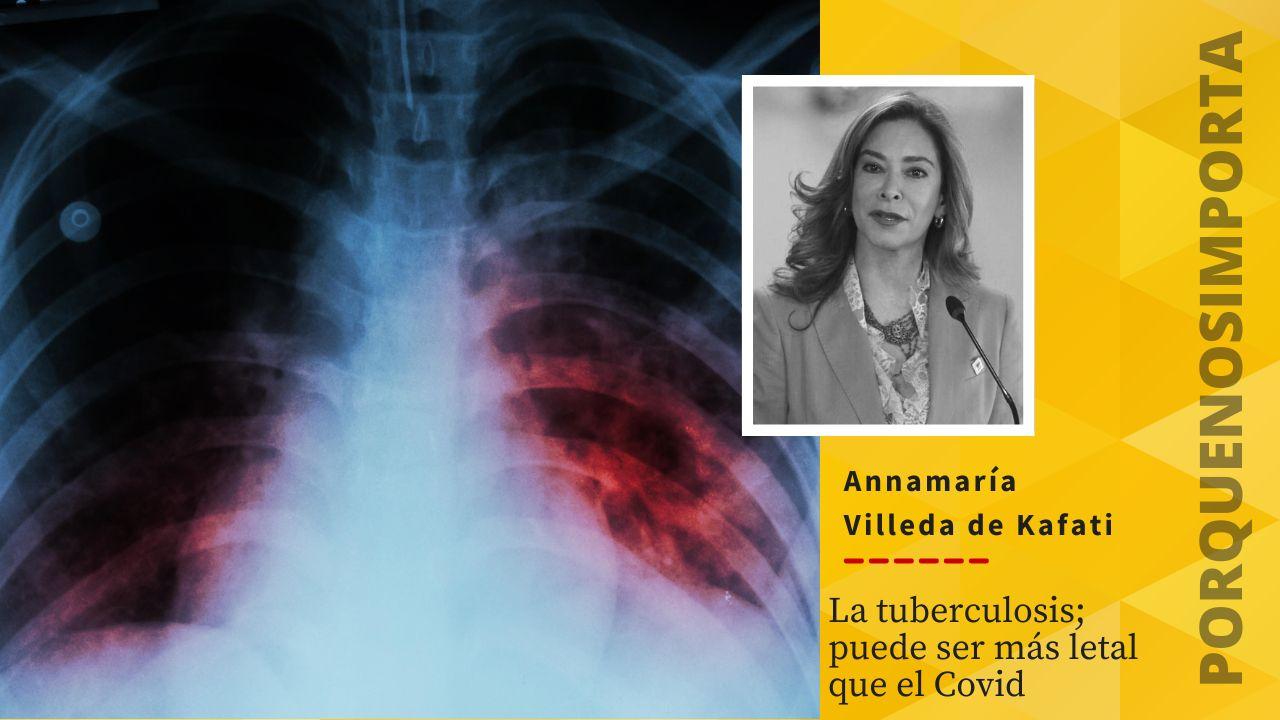 Imagen Principal de Nota: La tuberculosis puede ser más letal que el covid