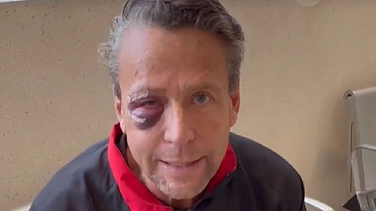 Imagen Principal de Nota: Alfredo Adame revela sentir miedo después de fuerte golpiza