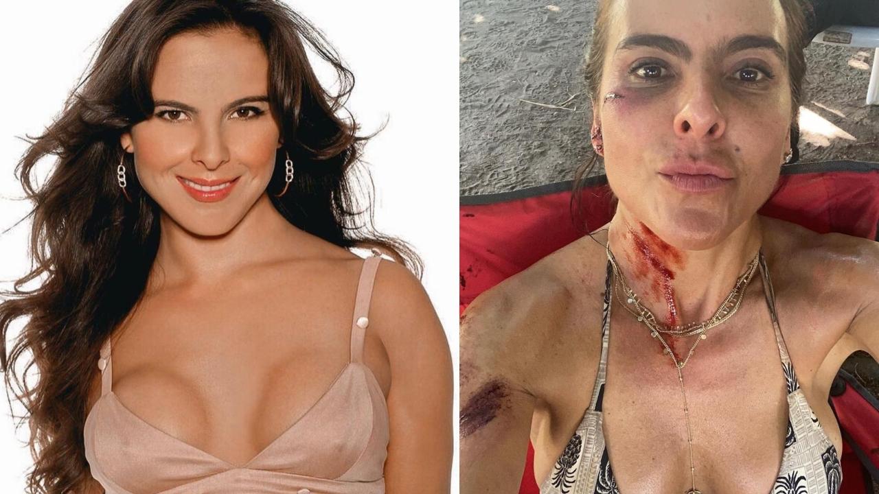 Imagen Principal de Nota: 'No me reconocí': Kate del Castillo habla del abuso doméstico que vivió con su expareja
