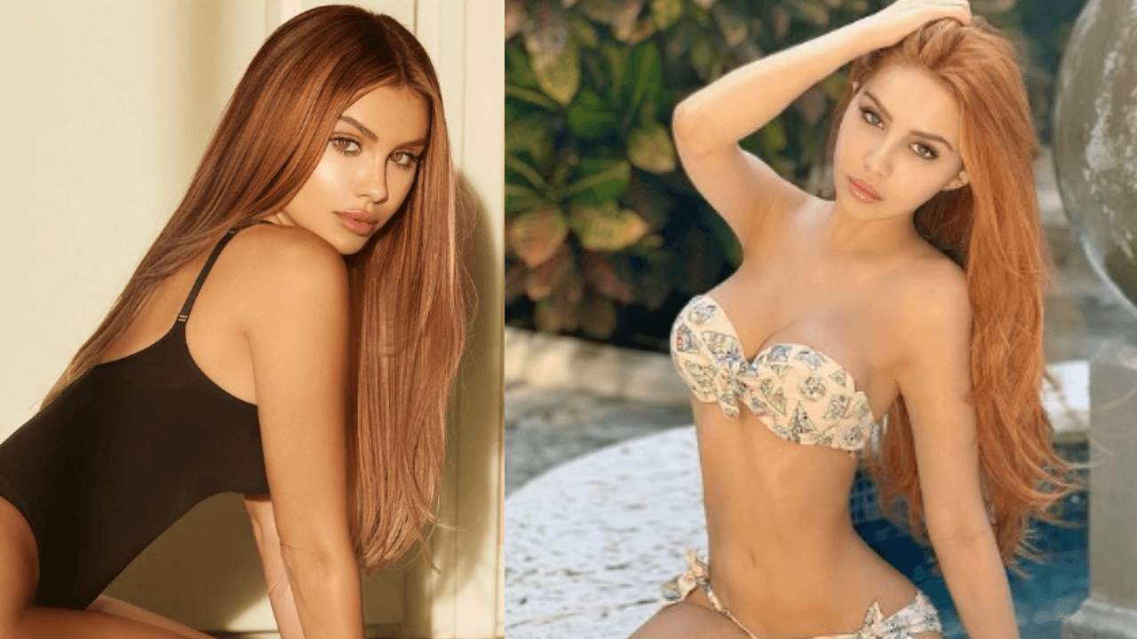 Imagen de Alexa Dellanos se somete a nueva cirugía estética y muestra sus resultados