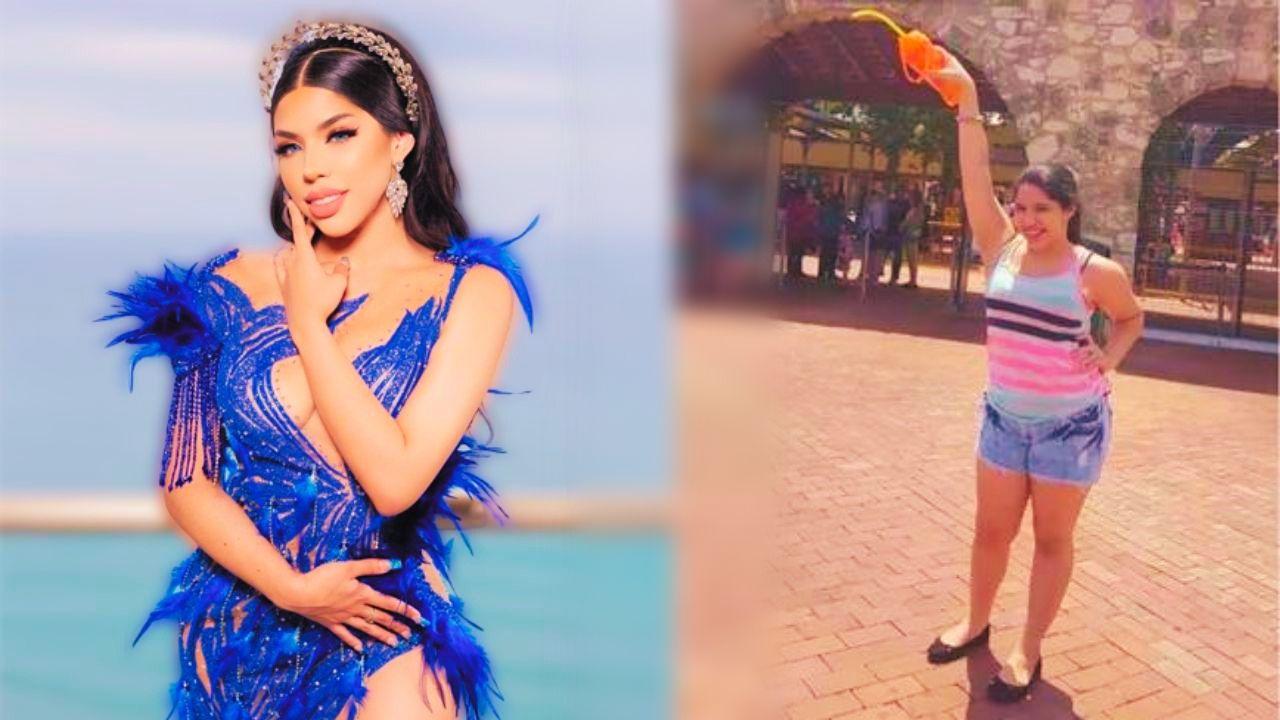 Imagen de Antes y después: así lucía Yeri Mua sin cirugías estéticas
