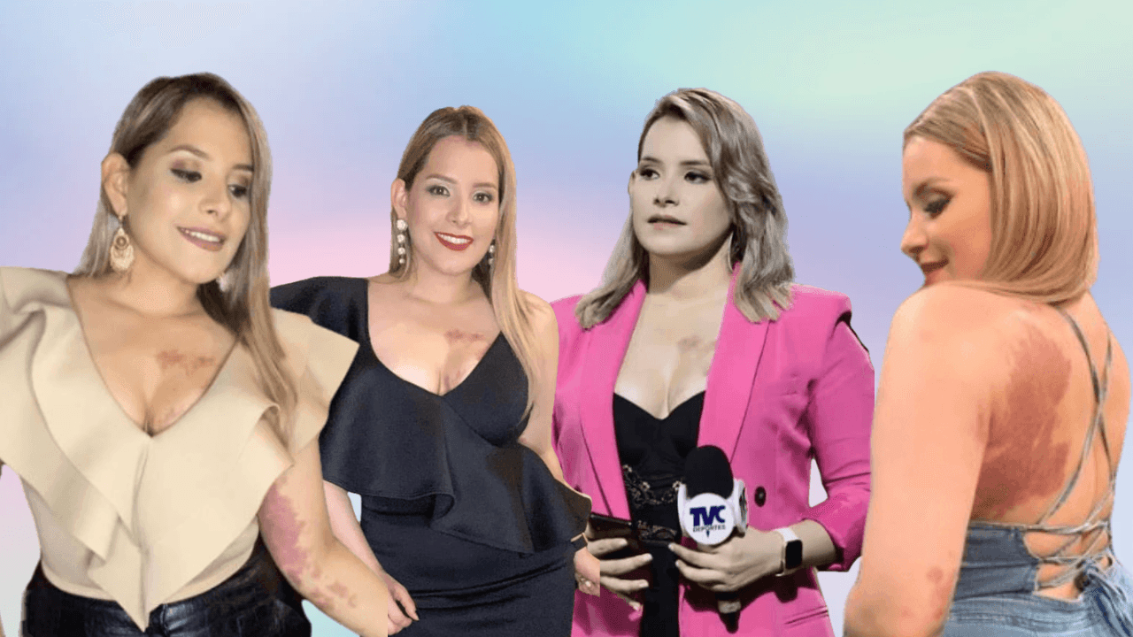 Imagen Principal de Nota: ‘Estoy cansada de tantos malos comentarios’: Tanya Rodríguez ante críticas por su lunar
