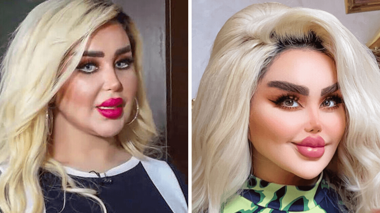 Imagen Principal de Nota: ¡Obsesión por ser Barbie! Actriz lleva 43 cirugías para parecer muñeca