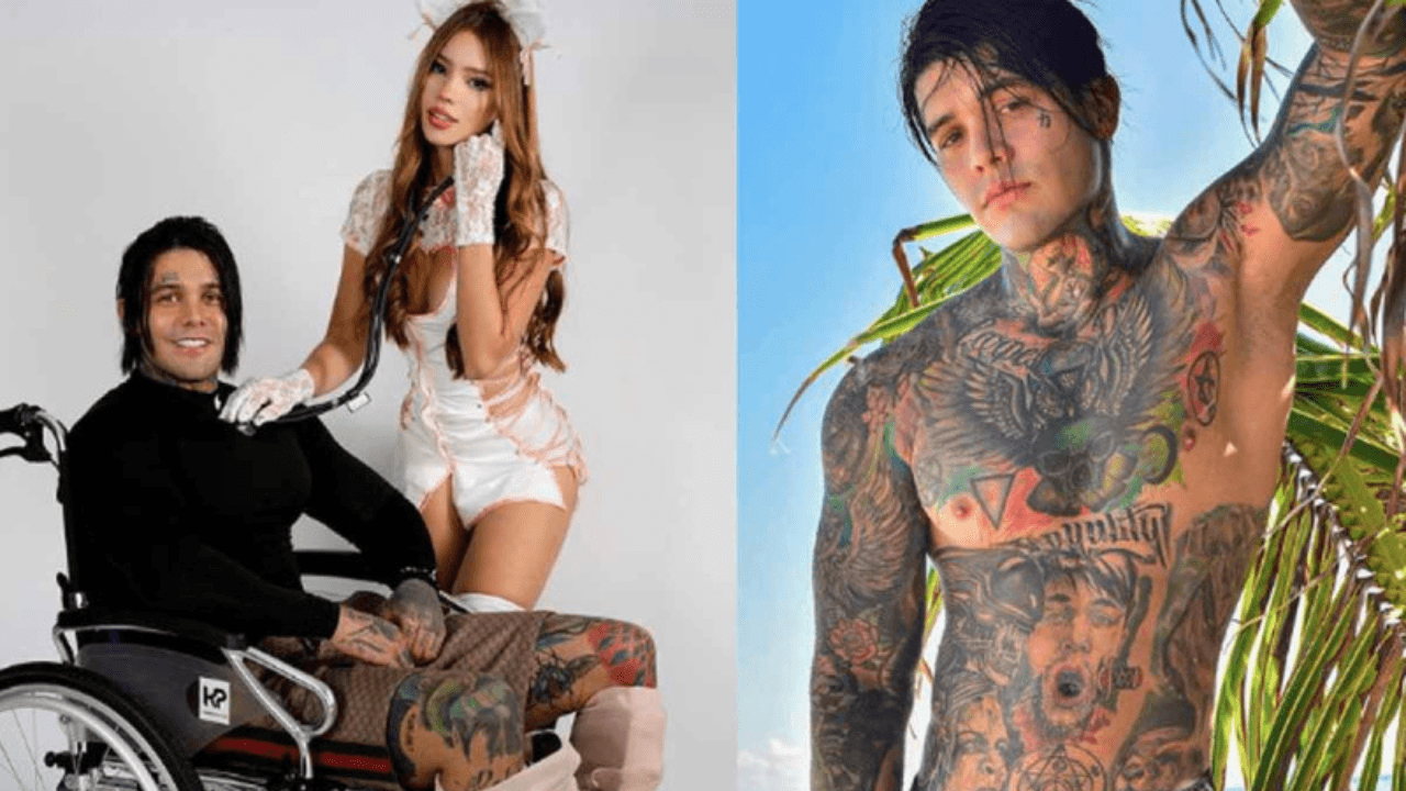 Imagen de Influencer Yeferson Cossio se aumenta la estatura y sufre doloroso resultado