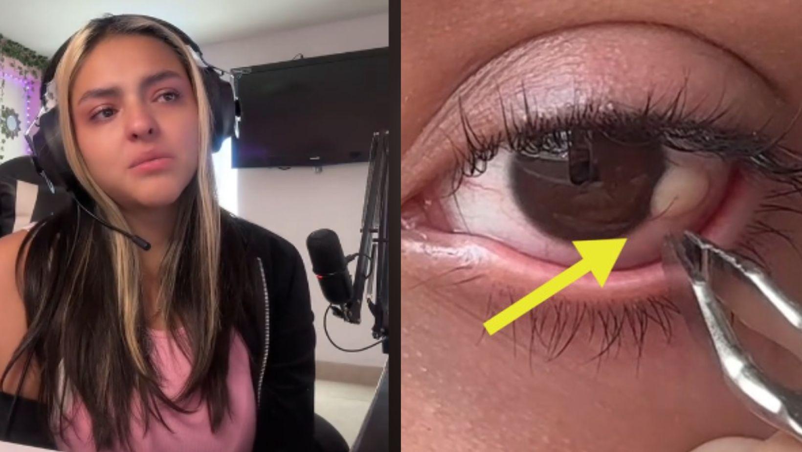 Imagen de Tiktoker causa polémica al mostrar cómo se depila el ojo