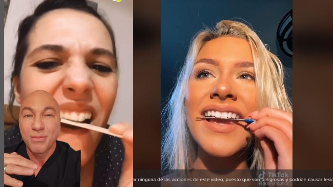 Imagen Principal de Nota: Limarse los dientes: la peligrosa moda que pone en riesgo a quienes la practican