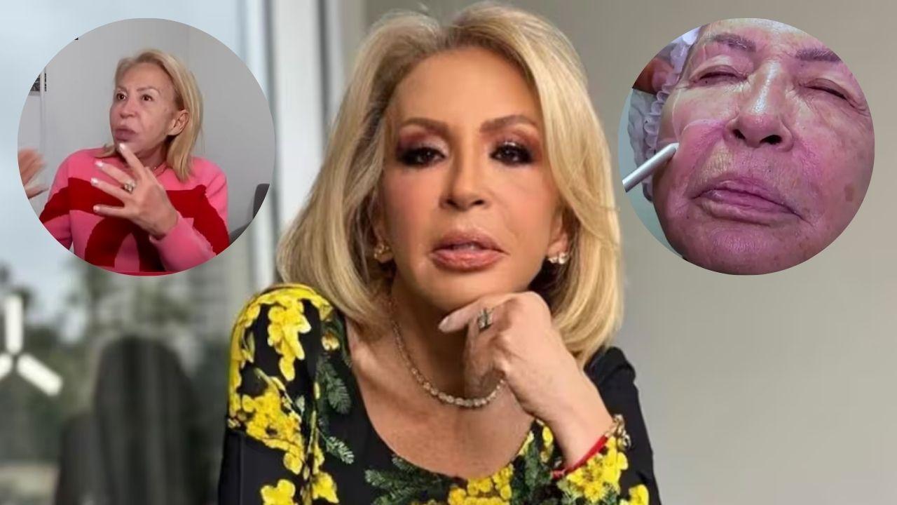 Imagen de Laura Bozzo revela su transformación  de rostro tras procedimiento estético en Perú