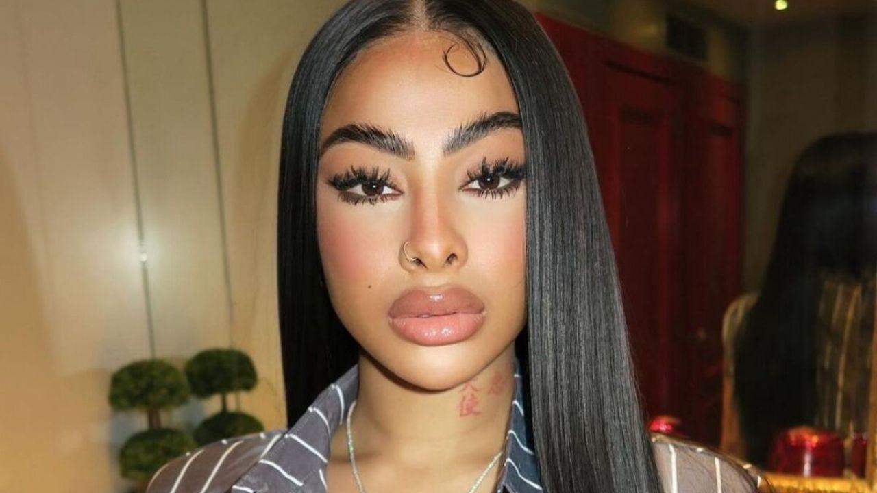 Imagen Principal de Nota: Yailin 'La más Viral' se opera otra vez, para verse "más natural"