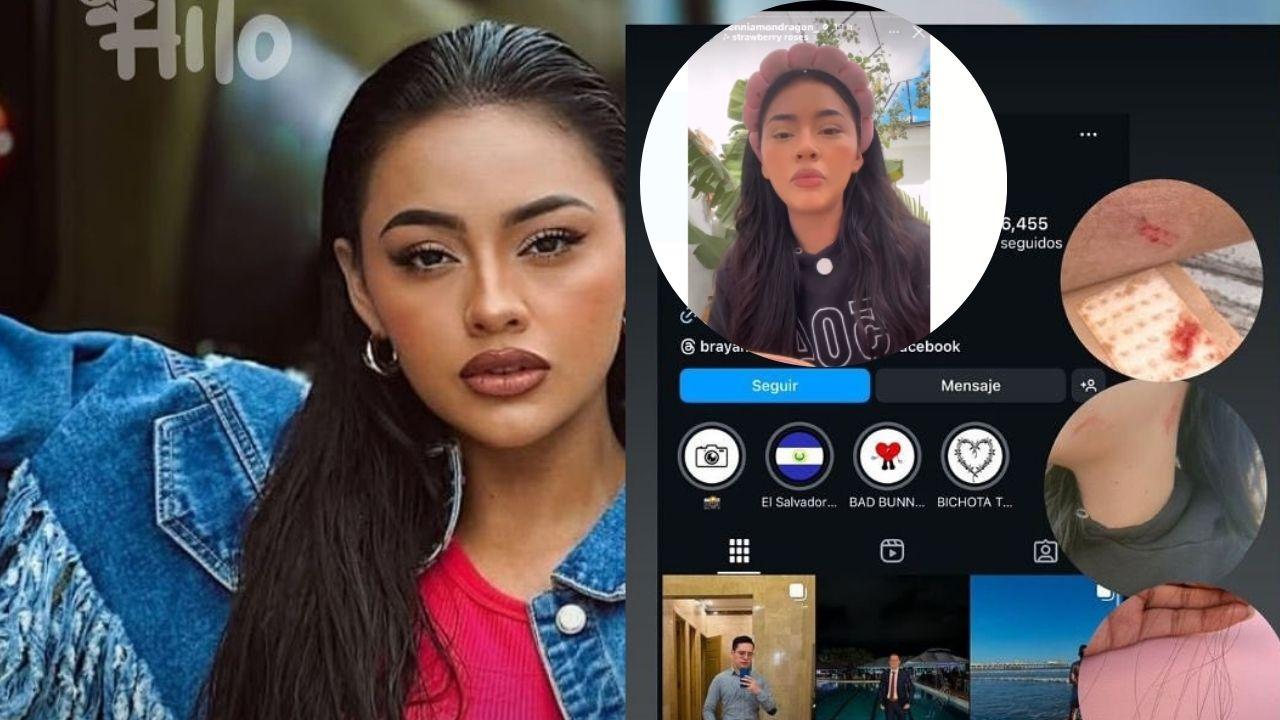 Imagen de Kennia Mondragón denuncia agresión del mejor amigo de su novio: ‘Él no es gay, le gusto yo’