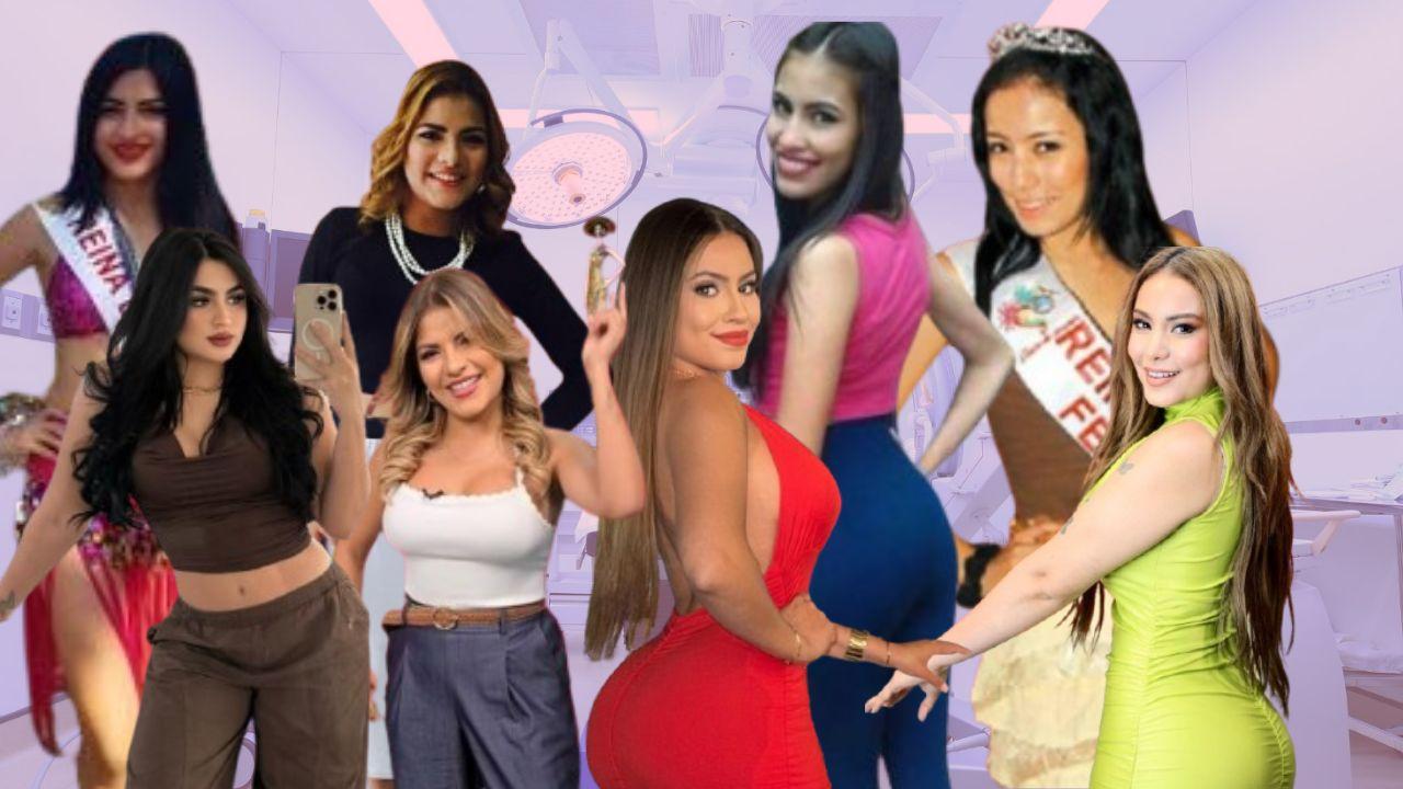 Imagen Principal de Nota: Hondureñas famosas que han apostado por las cirugías estéticas para transformar su imagen